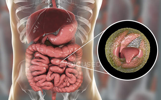 Cryptosporidium parvum parasite in human body causing cryptosporidiosis, digital illustration. — Stock Photo