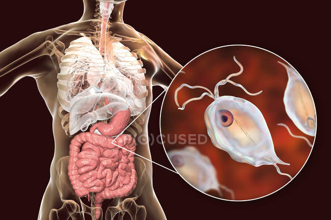 Pentatrichomonas hominis protozoan in human large intestine, digital illustration. — Stock Photo