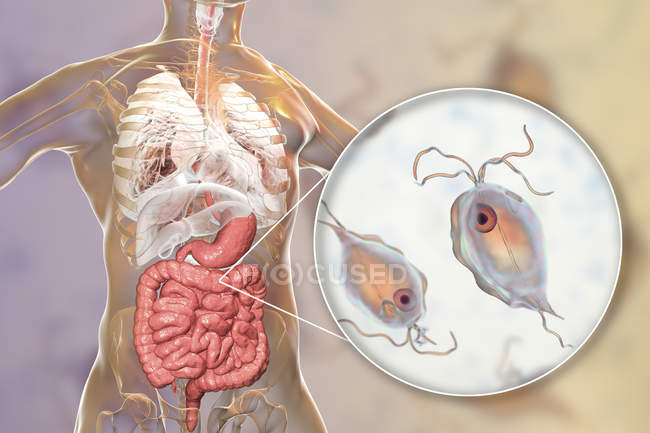 Pentatrichomonas hominis zoans в толстом кишечнике человека, цифровая иллюстрация
. — стоковое фото
