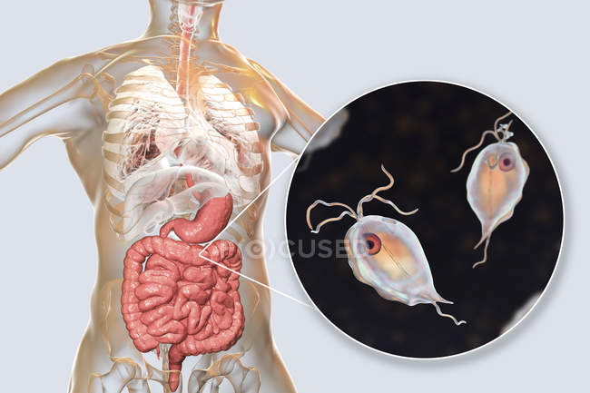 Pentatrichomonas hominis protozoos en intestino grueso humano, ilustración digital
. - foto de stock