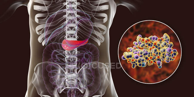 Pancréas dans le corps humain et vue rapprochée de la molécule d'insuline, illustration numérique
. — Photo de stock