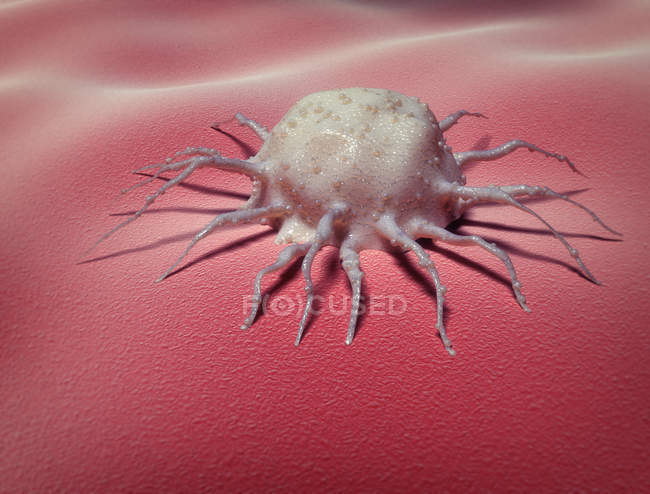 Células cancerosas adheridas al tejido del colon humano, ilustración conceptual . - foto de stock