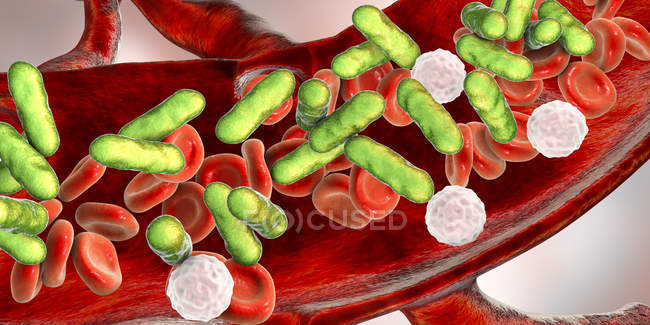 Infección bacteriana de la sangre, ilustración digital
. - foto de stock