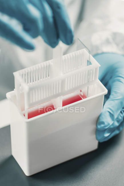 Mani di microbiologo che lavorano in laboratorio con campioni biotecnologici . — Foto stock
