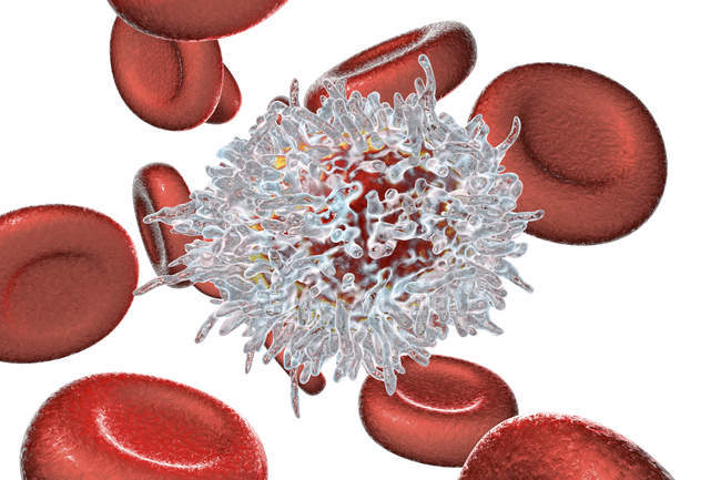 Ilustración digital de linfocitos B anormales de glóbulos blancos y leucemia de células pilosas
. - foto de stock