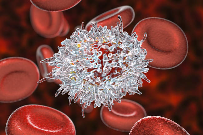 Цифрова ілюстрація аномальних білих кров'яних клітин B-лімфоцитів в той час як волохаті лейкотемія клітини. — стокове фото
