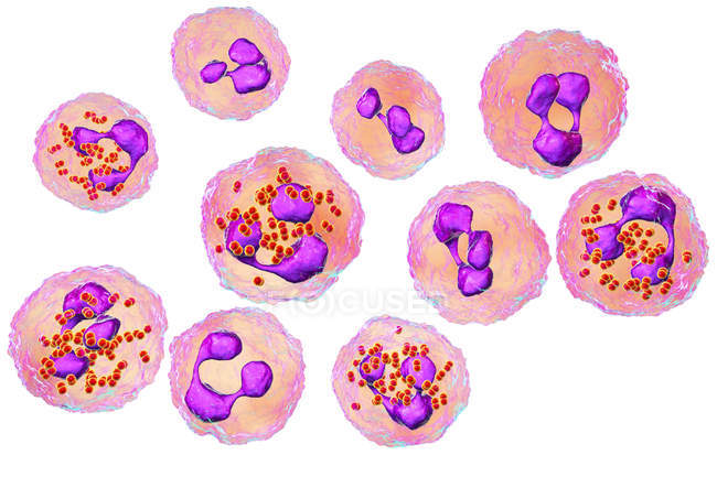 Digital illustration of cerebrospinal fluid and neutrophils with Neisseria meningitidis bacteria. — Stock Photo