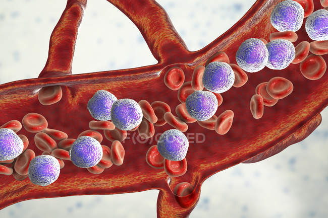 Digital illustration of cross-section of blood vessel with acute lymphoblastic leukaemia showing abundant lymphoblasts. — Stock Photo