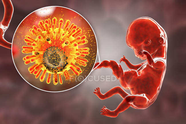 Prevenção da transmissão transplacentária do HIV para embrião humano de mãe infectada, ilustração conceitual
. — Fotografia de Stock