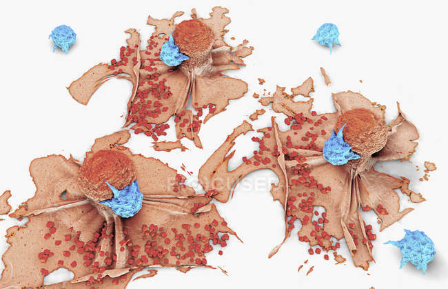3d ilustración de células cancerosas atacadas y asesinadas por linfocitos
. - foto de stock