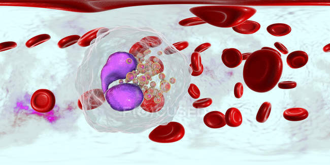 Panoramische Darstellung von Blutgefäßen mit Eosinophilie mit zahlreichen Eosinophilen weißer Blutkörperchen, Immunsystem gegen Parasiten. — Stockfoto