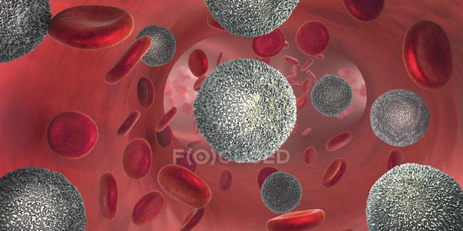 3d иллюстрация, показывающая увеличение нефункциональных белых кровяных телец при лейкемии
. — стоковое фото