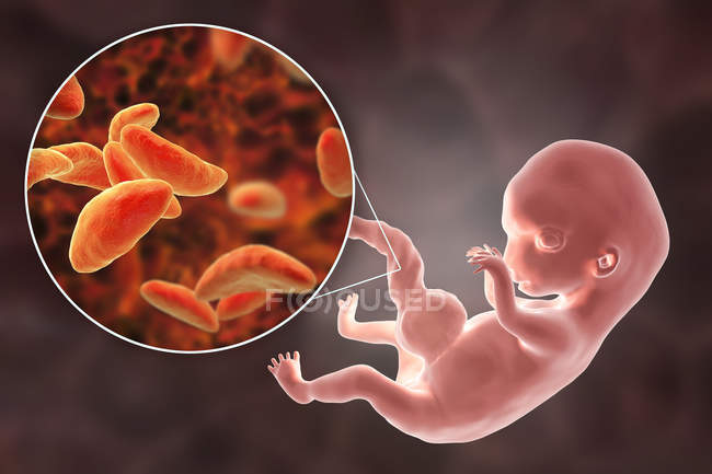 Transplazentäre Übertragung von Toxoplasma-Gondii-Parasiten auf menschliche Embryonen, konzeptionelle Illustration. — Stockfoto