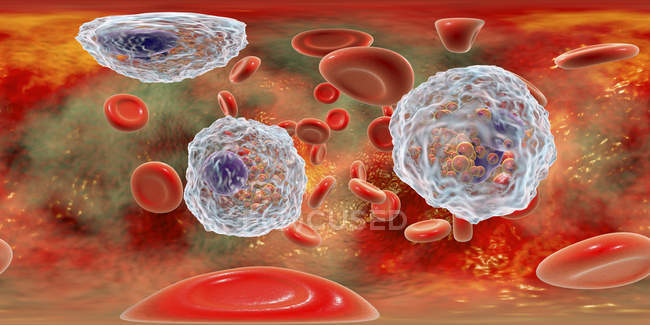 Ilustración panorámica de los vasos sanguíneos con eosinofilia con numerosos eosinófilos glóbulos blancos, sistema inmunitario antiparasitario
. - foto de stock
