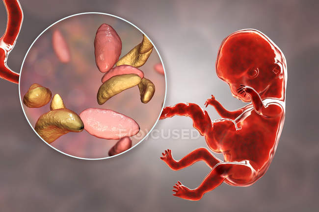 Transmissão transplacentária de parasitas Toxoplasma gondii para embrião humano, ilustração conceitual . — Fotografia de Stock