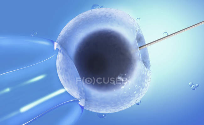 Illustrazione concettuale 3d dell'inseminazione artificiale, fecondazione in vitro di ovociti umani . — Foto stock