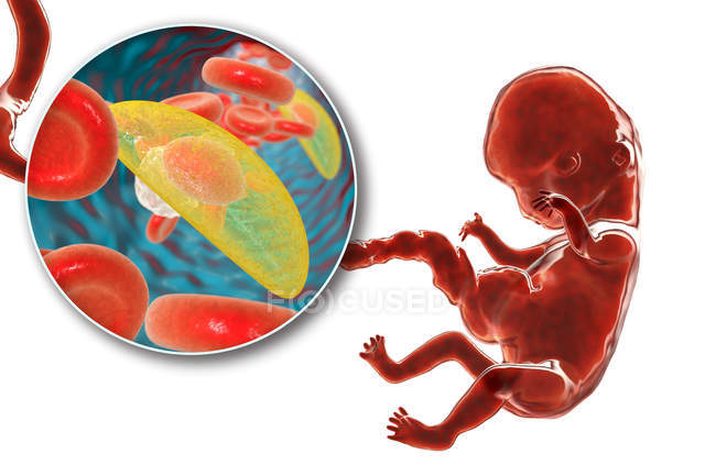 Trasmissione transplacentare dei parassiti Toxoplasma gondii all'embrione umano, illustrazione concettuale . — Foto stock