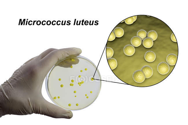 Imagen compuesta de mano científica con colonia de bacterias Micrococcus luteus en medio nutritivo - foto de stock