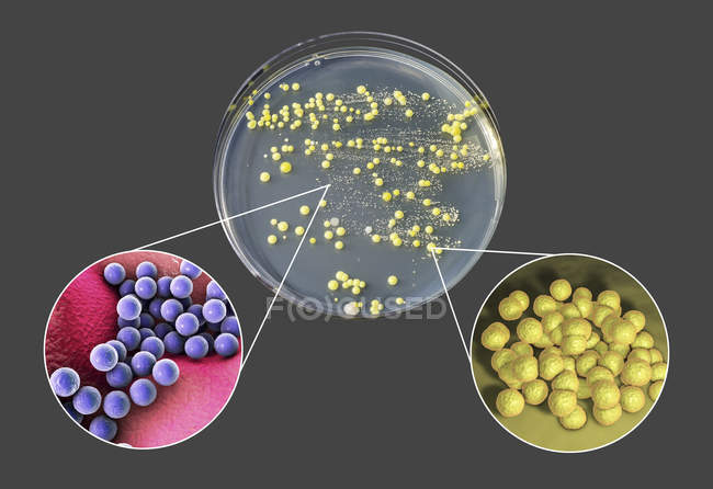 Бактериальная культура, выращенная из человеческой кожи на чашке Петри с питательной средой
. — стоковое фото