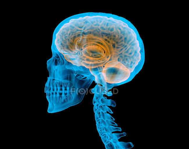 Calavera humana con cerebro con efecto de rayos X sobre fondo negro . - foto de stock