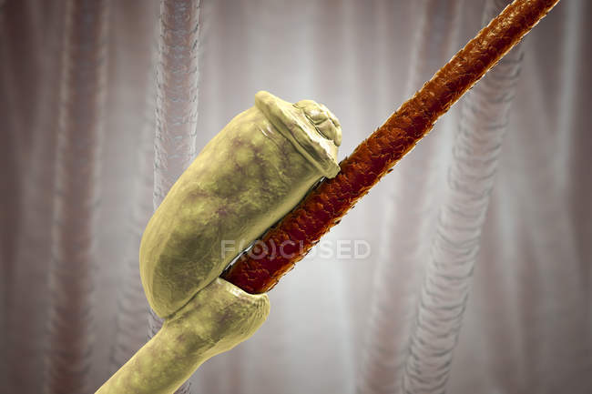 Digital illustration of nit egg of human head louse attached to human hair. — Stock Photo