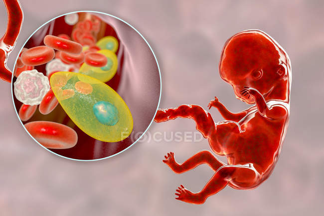 Трансплацентарная передача паразитов Toxoplasma gondii человеческому эмбриону, концептуальная иллюстрация
. — стоковое фото