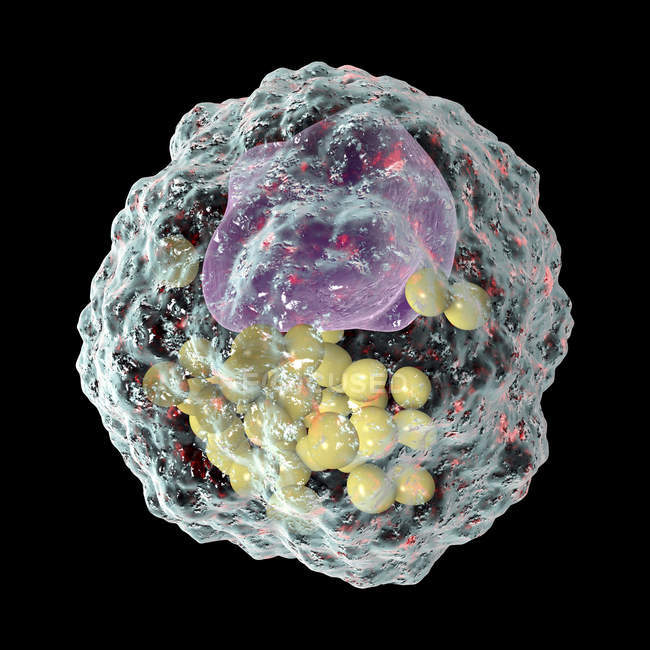 Макрофагів піни з крапельками ліпідів, цифровою ілюстрацією. — стокове фото