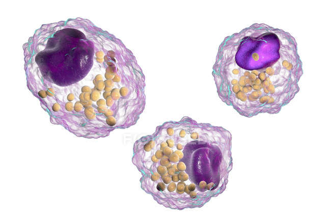 Makrophagen-Schaumzellen mit Fetttröpfchen, digitale Illustration. — Stockfoto