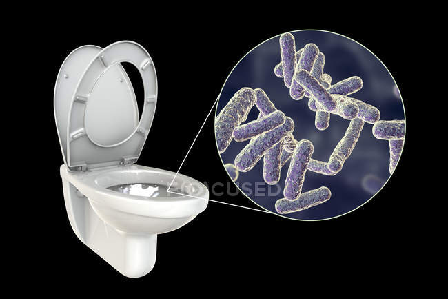 Microbes de toilettes à chasse d'eau sur surface contaminée, illustration numérique conceptuelle sur fond noir
. — Photo de stock