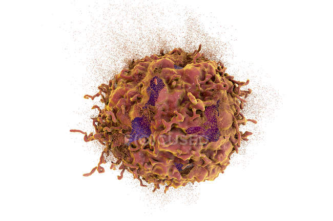 Zerstörung von Krebszellen, digitale konzeptionelle Illustration zur Behandlung von Krebs durch Medikamente, Nanopartikel und Antikörper. — Stockfoto