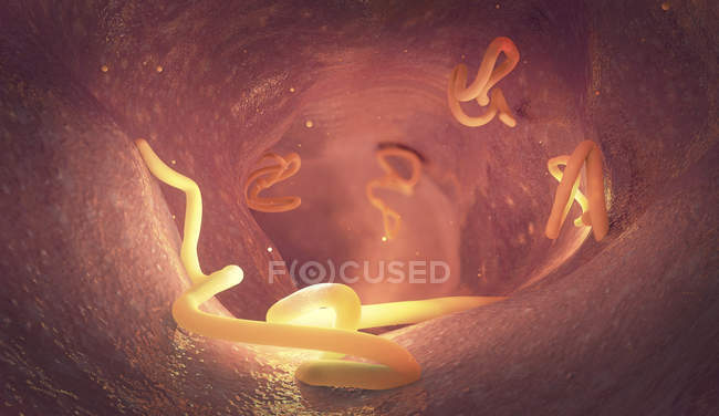 Инвазия ленточных червей в кишечнике человека, цифровая иллюстрация . — стоковое фото