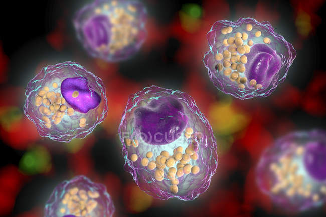 Células de espuma de macrófagos com gotículas lipídicas, ilustração digital . — Fotografia de Stock
