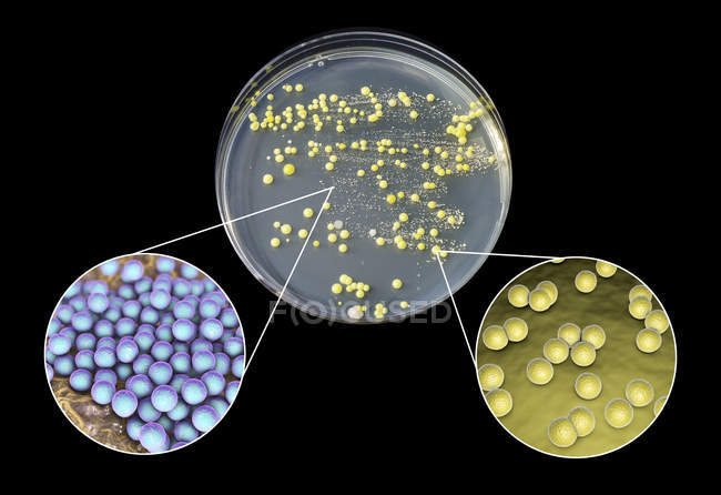 Bakterienkultur aus menschlicher Haut auf Petrischale mit Nährmedium. — Stockfoto