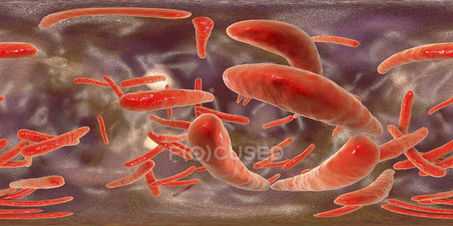 Digitale Illustration von Mycobacterium tuberculosis gram-positive stabförmige Bakterien, die Tuberkulose verursachen. — Stockfoto