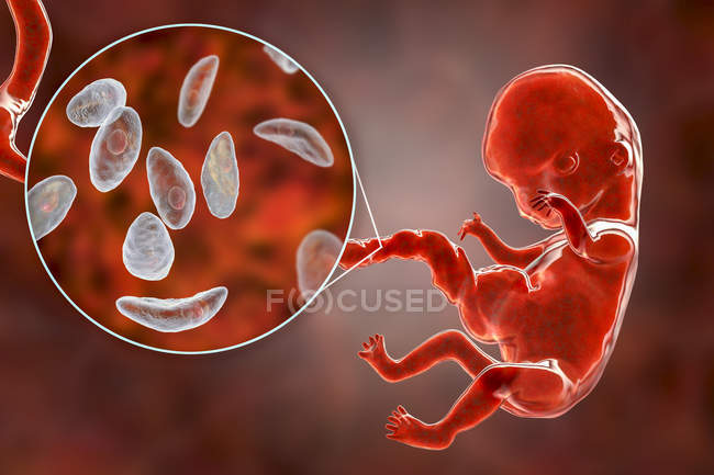 Transplacental трансмісія паразит Toxoplasma gondii до людського ембріона, концептуальні ілюстрації. — стокове фото