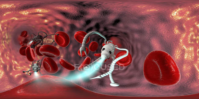 Медичний наноробот у кровоносних судинах людини, панорамна цифрова ілюстрація . — стокове фото
