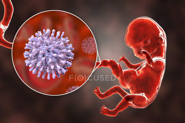 Transplazentäre Übertragung von hiv infizierenden menschlichen Embryonen, 8 Wochen, konzeptionelle Illustration. — Stockfoto