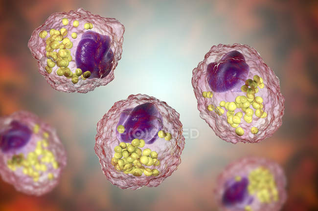 Células de espuma de macrófago con gotitas lipídicas, ilustración digital . - foto de stock