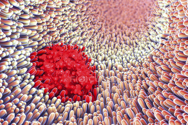 3d illustration of intestinal villi and stomach ulcer. — Stock Photo