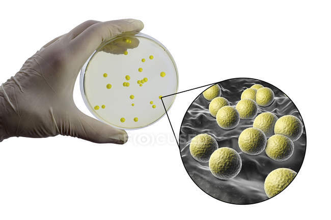 Композитное изображение руки ученого с колонией бактерий Micrococcus luteus в питательной среде — стоковое фото