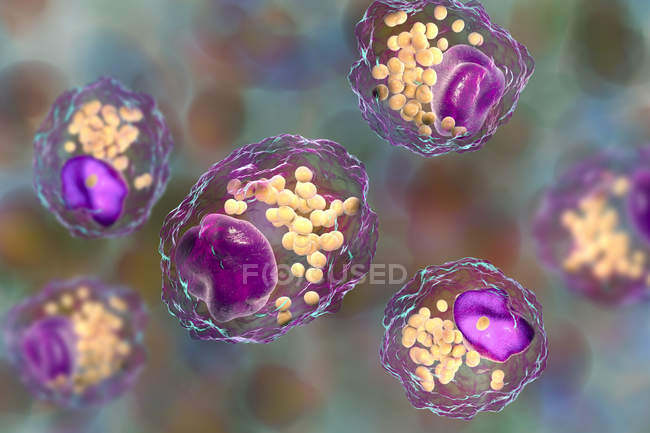 Células de espuma de macrófagos com gotículas lipídicas, ilustração digital . — Fotografia de Stock