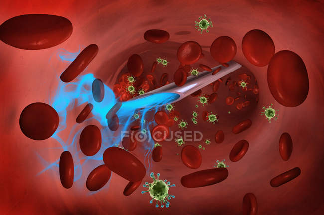 Illustration d'un liquide bleu injecté dans la circulation sanguine avec une seringue vue de l'intérieur avec du sang et des cellules virales vertes . — Photo de stock