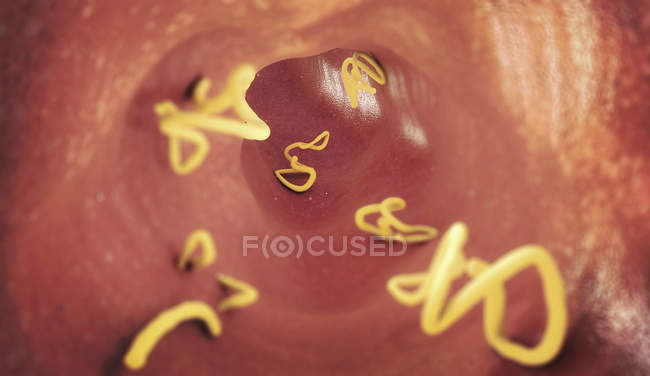 Ininfestazione da tenie nell'intestino umano, illustrazione digitale . — Foto stock