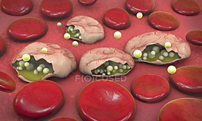 3d ilustración de células sanguíneas y parásitos del Plasmodium que causan malaria . - foto de stock
