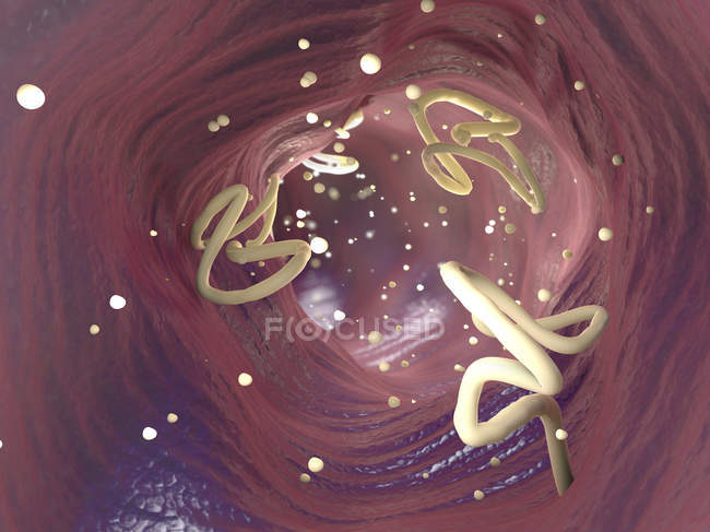 3d ilustración de la infestación de tenias en el intestino humano . - foto de stock