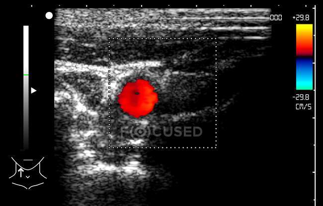 Colored carotid artery, medical doppler ultrasound scan. — Stock Photo
