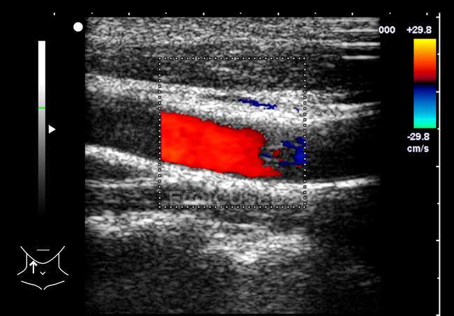 Colored carotid artery, medical doppler ultrasound scan. — Stock Photo