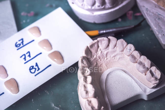 Protesi dentarie e denti artificiali in laboratorio, primo piano . — Foto stock