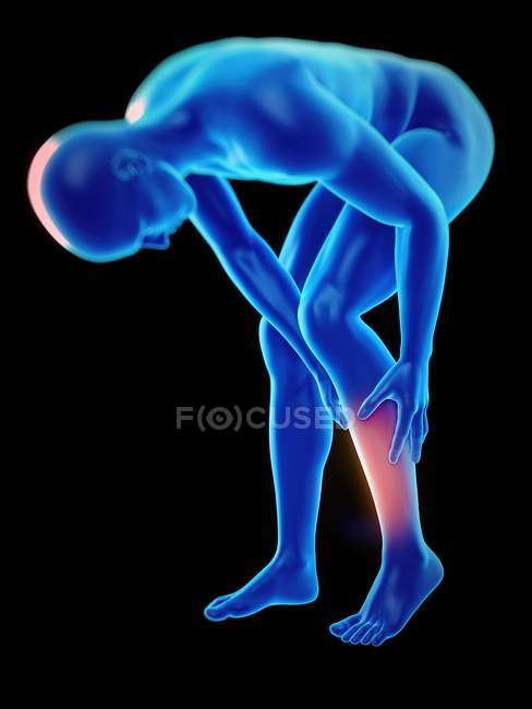 Human silhouette with leg ache, digital illustration. — Stock Photo