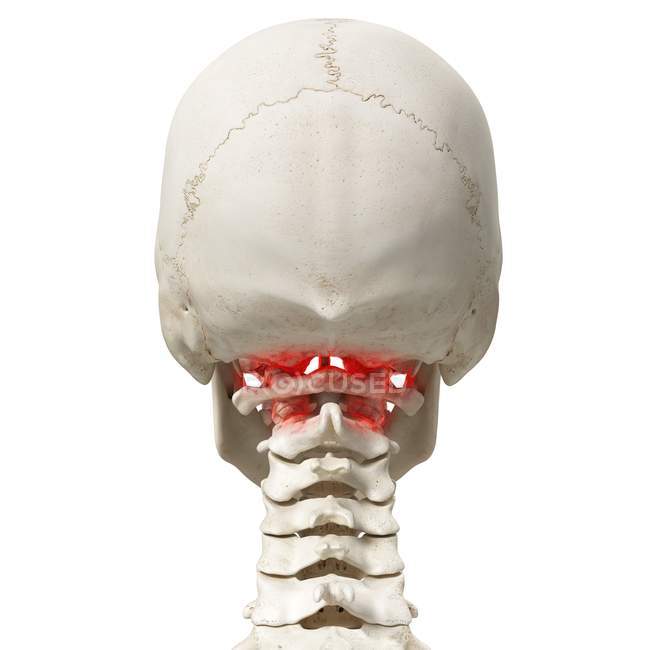 Ilustración digital realista que muestra artritis en vértebras de atlas humanas . - foto de stock